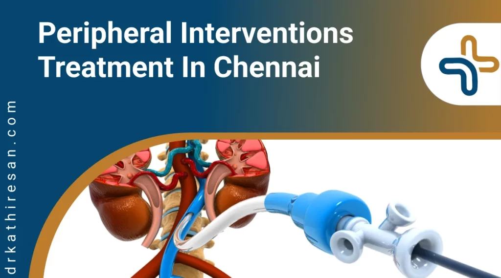Peripheral Interventions treatment in chennai