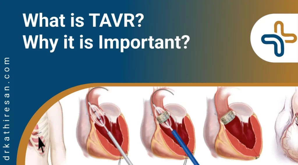 transcatheter aortic valve implantation
