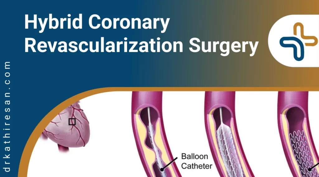 Coronary Revascularization