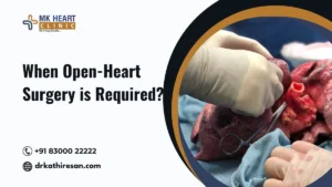 Why or When Open-Heart Surgery is Required?