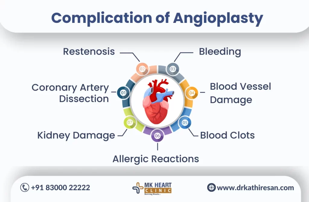 Complex Coronary Angioplasty | Dr. M. Kathiresan