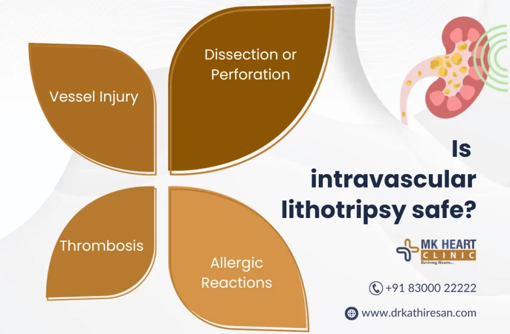 Intravascular Shock wave Lithotripsy in Chennai | Dr. M. Kathiresan