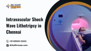 Intravascular Shock wave Lithotripsy in Chennai