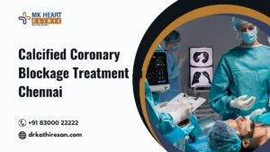 Calcified Coronary Blockage Treatment in Chennai