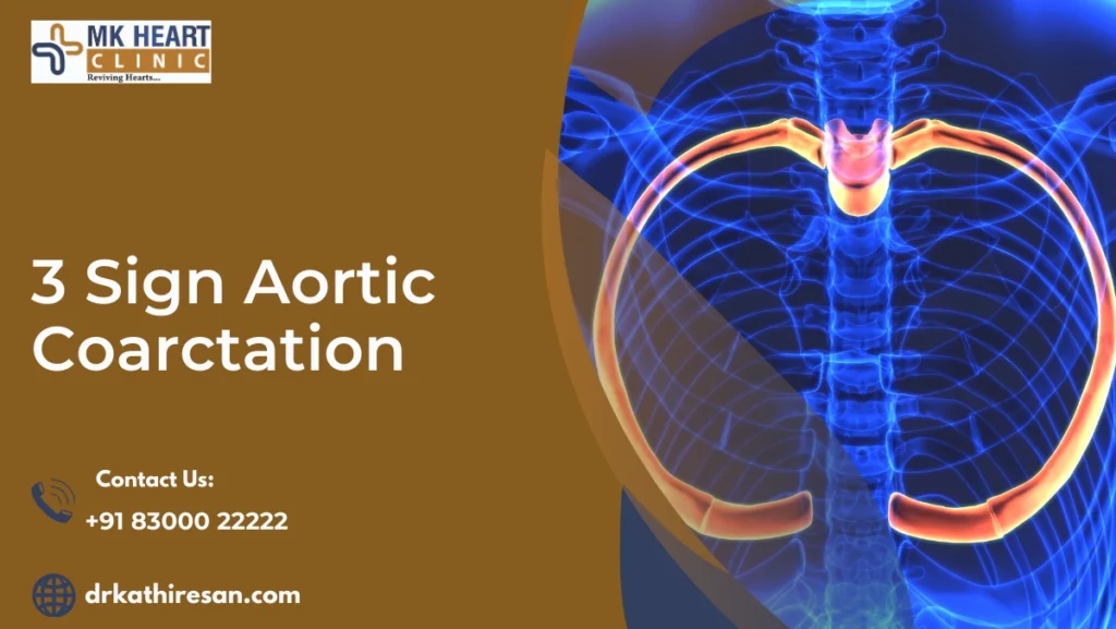 3 sign aortic coarctation