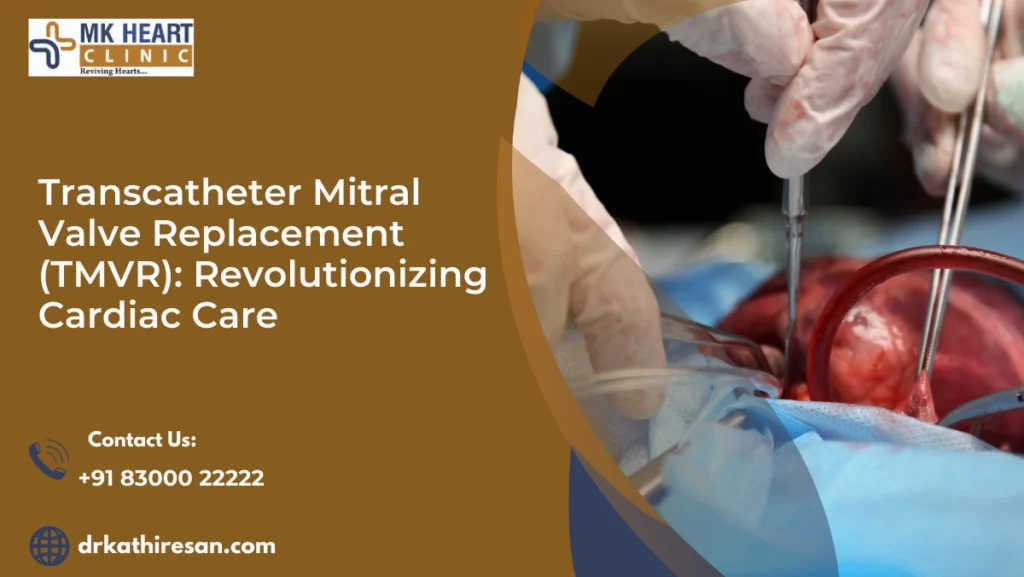 Transcatheter Mitral Valve Replacement In Chennai